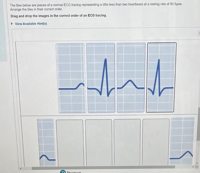 The tiles below are pieces of a normal ecg