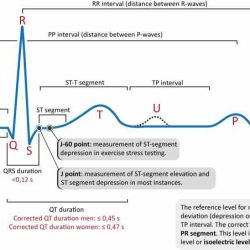 Ecg tracing heartbeats representing bpm resting arrange drag hint homework