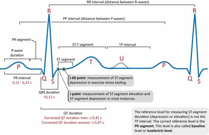 Ecg tracing heartbeats representing bpm resting arrange drag hint homework